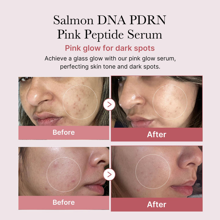 Medicube PDRN Pink Peptide Serum – Rose PDRN (Vegan) – 30ml