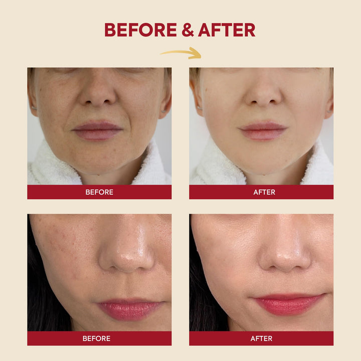 K-SECRET Snail Mucin Essence Serum: 97% Snail Secretion & Rice Ferment Filtrate & Rice Extract for Skin Hydration Soothing and Balancing - SEOUL 1988 Korean Skincare Cruelty Free Paraben Free 100mL